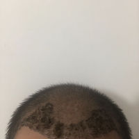 發(fā)際線用戶(hù)圖片