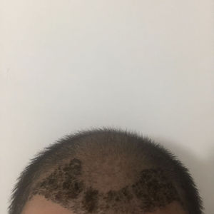 发际线分享社区
