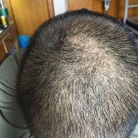 發(fā)際線用戶(hù)圖片