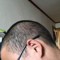 發(fā)際線用戶(hù)圖片
