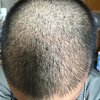 發(fā)際線用戶(hù)圖片