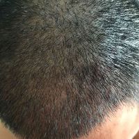 發(fā)際線用戶(hù)圖片