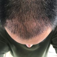 發(fā)際線用戶(hù)圖片