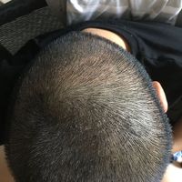 發(fā)際線用戶圖片