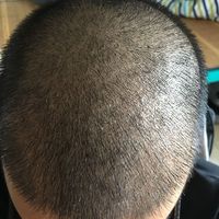 發(fā)際線用戶圖片