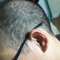 發(fā)際線用戶圖片