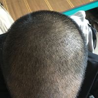 發(fā)際線用戶圖片