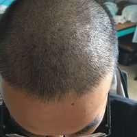 發(fā)際線用戶圖片