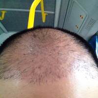 發(fā)際線用戶圖片