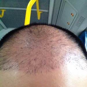 发际线分享社区