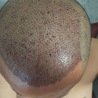 禿頂用戶圖片