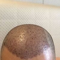 發(fā)際線用戶圖片