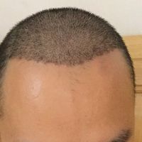 發(fā)際線用戶圖片