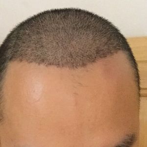 发际线分享社区