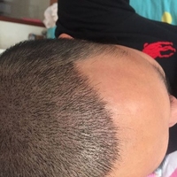 發(fā)際線用戶圖片
