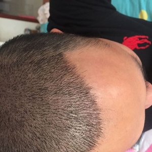 发际线分享社区