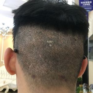 发际线分享社区