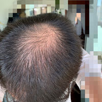 發(fā)際線用戶圖片