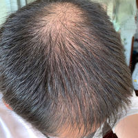 發(fā)際線用戶圖片