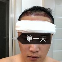 發(fā)際線用戶圖片