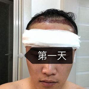 发际线分享社区