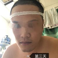 發(fā)際線用戶圖片
