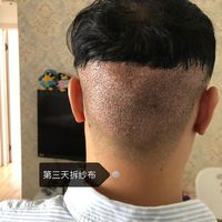 發(fā)際線用戶圖片