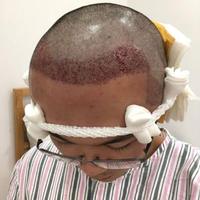 發(fā)際線用戶圖片