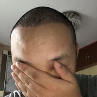 發(fā)際線用戶圖片