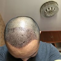 發(fā)際線用戶圖片