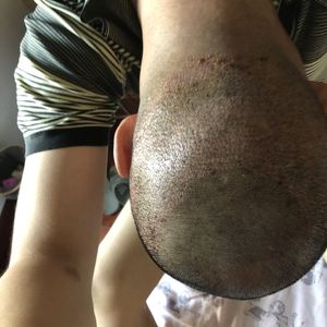 发际线分享社区