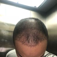 發(fā)際線用戶圖片
