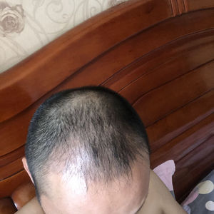 发际线分享社区