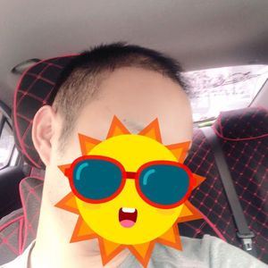 发际线分享社区