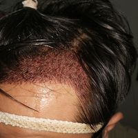 發(fā)際線用戶圖片