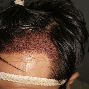 发际线分享社区