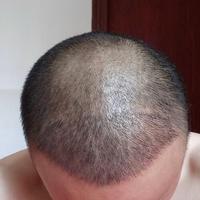 發(fā)際線用戶圖片