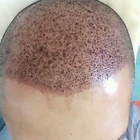禿頂用戶圖片