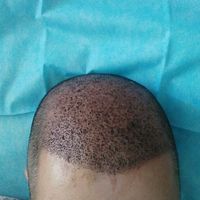 發(fā)際線用戶圖片