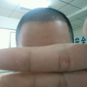 发际线分享社区