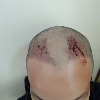 發(fā)際線用戶圖片