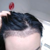 發(fā)際線用戶圖片