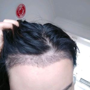 发际线分享社区