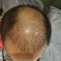 禿頂用戶圖片