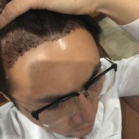 發(fā)際線用戶圖片