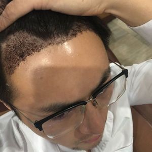 发际线分享社区