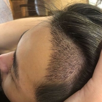 發(fā)際線用戶圖片