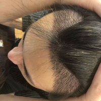 發(fā)際線用戶圖片