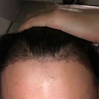 發(fā)際線用戶圖片