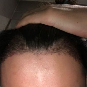 发际线分享社区